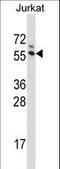 G3BP Stress Granule Assembly Factor 1 antibody, LS-C166301, Lifespan Biosciences, Western Blot image 