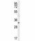 NK2 Homeobox 1 antibody, F40894-0.4ML, NSJ Bioreagents, Western Blot image 