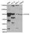 Signal Transducer And Activator Of Transcription 5B antibody, MBS125523, MyBioSource, Western Blot image 