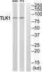 Tousled Like Kinase 1 antibody, TA312355, Origene, Western Blot image 