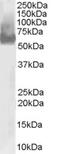 WAS antibody, EB06675, Everest Biotech, Western Blot image 