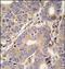 CysRS antibody, AP14683PU-N, Origene, Immunohistochemistry paraffin image 