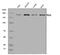 DNA Polymerase Alpha 1, Catalytic Subunit antibody, A04421-1, Boster Biological Technology, Western Blot image 