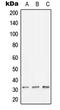 Major Histocompatibility Complex, Class II, DO Beta antibody, LS-C352298, Lifespan Biosciences, Western Blot image 