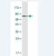 Proteasome 26S Subunit, ATPase 6 antibody, H00005706-M04, Novus Biologicals, Western Blot image 