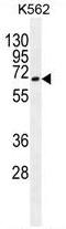 Autophagy Related 16 Like 2 antibody, AP50287PU-N, Origene, Western Blot image 