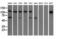 Insulin Like Growth Factor 2 MRNA Binding Protein 2 antibody, GTX84309, GeneTex, Western Blot image 