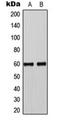 SMAD Family Member 3 antibody, orb216147, Biorbyt, Western Blot image 