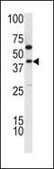 Thymine DNA Glycosylase antibody, 62-366, ProSci, Western Blot image 