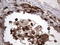 Galectin 3 antibody, LS-C790336, Lifespan Biosciences, Immunohistochemistry paraffin image 