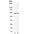 Lysyl Oxidase Like 1 antibody, R32201, NSJ Bioreagents, Western Blot image 