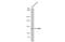 Discoidin Domain Receptor Tyrosine Kinase 2 antibody, GTX102651, GeneTex, Western Blot image 