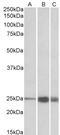 Troponin I2, Fast Skeletal Type antibody, STJ72984, St John