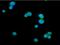 Cytotoxic T-Lymphocyte Associated Protein 4 antibody, NBP2-42630, Novus Biologicals, Western Blot image 