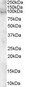 ADAM Metallopeptidase Domain 12 antibody, LS-B2756, Lifespan Biosciences, Western Blot image 