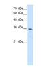 Methylenetetrahydrofolate Dehydrogenase (NADP+ Dependent) 2, Methenyltetrahydrofolate Cyclohydrolase antibody, NBP1-54655, Novus Biologicals, Western Blot image 