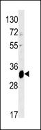 ELOVL Fatty Acid Elongase 6 antibody, MBS9213181, MyBioSource, Western Blot image 