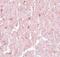 Nuclear Receptor Subfamily 1 Group H Member 3 antibody, PA5-20880, Invitrogen Antibodies, Immunohistochemistry frozen image 