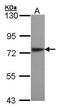 Lysyl-TRNA Synthetase antibody, GTX102113, GeneTex, Western Blot image 