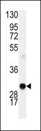 Cyclin D1 antibody, MBS9214117, MyBioSource, Western Blot image 