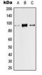 Transient Receptor Potential Cation Channel Subfamily V Member 1 antibody, LS-C353806, Lifespan Biosciences, Western Blot image 