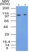 Fms Related Tyrosine Kinase 3 antibody, NBP2-42210, Novus Biologicals, Western Blot image 