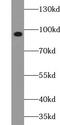 VPS41 Subunit Of HOPS Complex antibody, FNab09442, FineTest, Western Blot image 