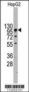 Cadherin 4 antibody, MBS9202103, MyBioSource, Western Blot image 