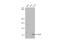 Zinc Finger And BTB Domain Containing 16 antibody, GTX111046, GeneTex, Western Blot image 