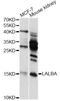 Lactalbumin Alpha antibody, LS-C747775, Lifespan Biosciences, Western Blot image 