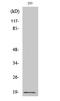 Stathmin 1 antibody, A01194S16, Boster Biological Technology, Western Blot image 