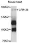 Adhesion G Protein-Coupled Receptor G6 antibody, abx125899, Abbexa, Western Blot image 