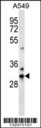 CMT1A Duplicated Region Transcript 15 Like 2 antibody, 56-491, ProSci, Western Blot image 