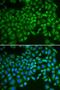 Selectin E antibody, LS-C331973, Lifespan Biosciences, Immunofluorescence image 