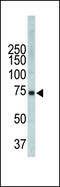 Tyrosine-protein kinase ITK/TSK antibody, 63-163, ProSci, Western Blot image 