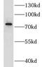 G Protein-Coupled Receptor Kinase 2 antibody, FNab03653, FineTest, Western Blot image 