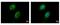 Interleukin 6 Signal Transducer antibody, PA5-28932, Invitrogen Antibodies, Immunofluorescence image 