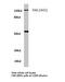 Protein Tyrosine Kinase 2 antibody, LS-C176511, Lifespan Biosciences, Western Blot image 