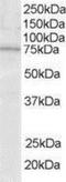 Lymphocyte Cytosolic Protein 2 antibody, NB100-1439, Novus Biologicals, Western Blot image 
