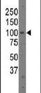 Poly(ADP-Ribose) Polymerase Family Member 12 antibody, PA5-13311, Invitrogen Antibodies, Western Blot image 