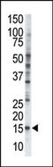 Transmembrane Protein 189 antibody, AP12060PU-N, Origene, Western Blot image 