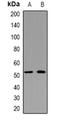 Keratin 14 antibody, orb382653, Biorbyt, Western Blot image 