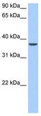 AlkB Homolog 8, TRNA Methyltransferase antibody, TA343982, Origene, Western Blot image 