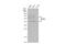 CD63 Molecule antibody, GTX135220, GeneTex, Western Blot image 