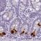 Regenerating Family Member 3 Alpha antibody, NBP2-48903, Novus Biologicals, Immunohistochemistry paraffin image 