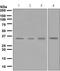 Kallikrein Related Peptidase 2 antibody, ab124899, Abcam, Western Blot image 