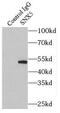 Sorting Nexin 5 antibody, FNab08094, FineTest, Immunoprecipitation image 