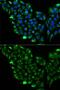 Short-chain specific acyl-CoA dehydrogenase, mitochondrial antibody, GTX55489, GeneTex, Immunofluorescence image 