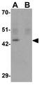 Kruppel Like Factor 4 antibody, GTX17300, GeneTex, Western Blot image 