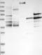 IKAROS Family Zinc Finger 3 antibody, NBP1-89185, Novus Biologicals, Western Blot image 